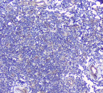 Anti-CD272/BTLA Antibody