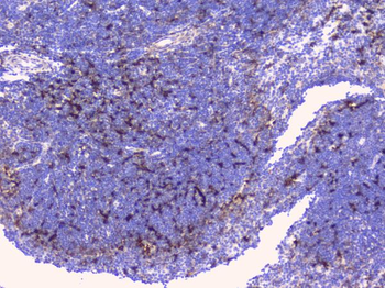 Anti-CD272/BTLA Antibody