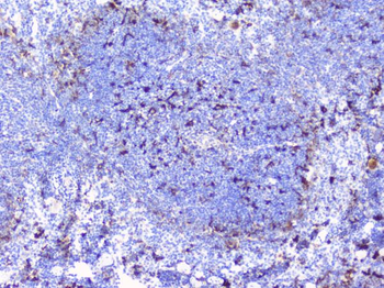 Anti-CD272/BTLA Antibody
