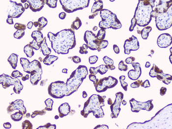 Anti-Aromatase/CYP19A1 Antibody