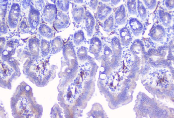 Anti-Aromatase/CYP19A1 Antibody