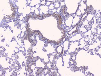 Anti-Aromatase/CYP19A1 Antibody