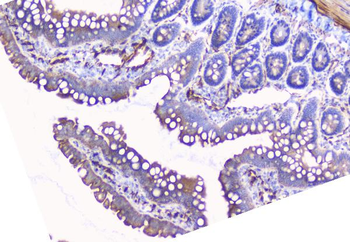 Anti-Aromatase/CYP19A1 Antibody