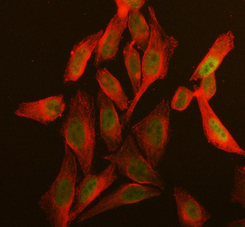 DIS3 Antibody
