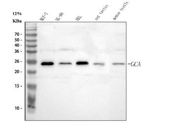 Grancalcin/GCA Antibody