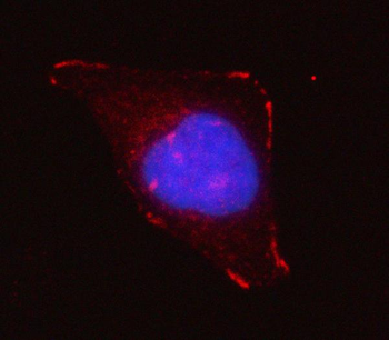Anti-Grancalcin/GCA Antibody