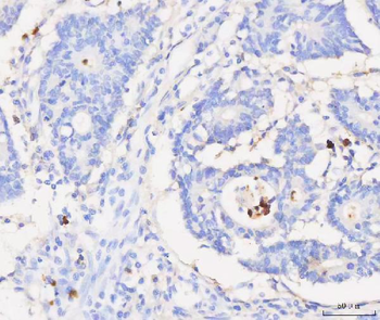 Anti-Grancalcin/GCA Antibody