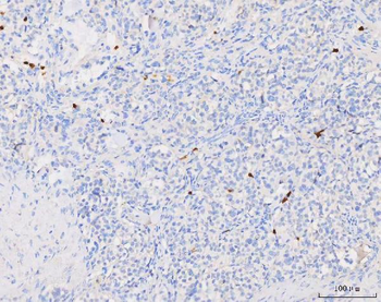 Anti-Grancalcin/GCA Antibody