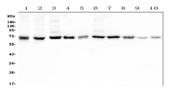 Hyaluronan synthase 1/HAS1 Antibody
