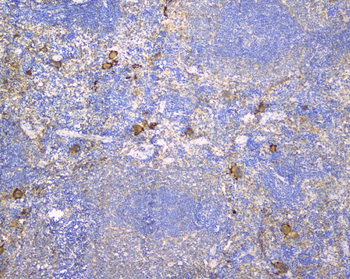 Anti-CD229/LY9 Antibody