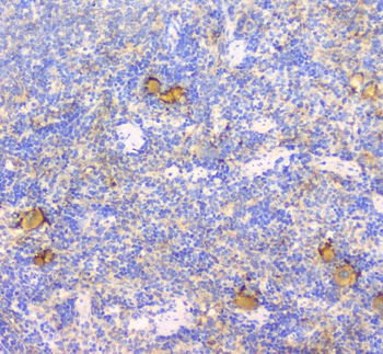 Anti-CD229/LY9 Antibody