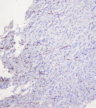 Anti-Myelin oligodendrocyte glycoprotein/MOG Antibody