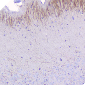 Anti-Myelin oligodendrocyte glycoprotein/MOG Antibody