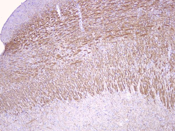Anti-Myelin oligodendrocyte glycoprotein/MOG Antibody
