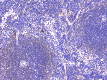 PCDH15 Antibody