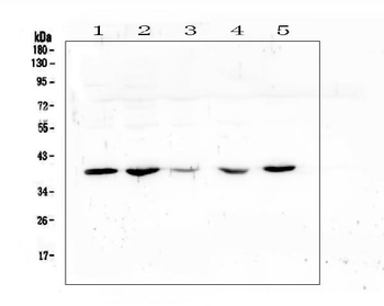 Anti-uPA Receptor/PLAUR Antibody