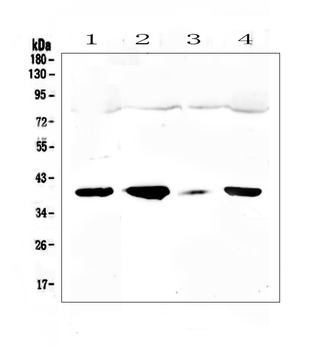 Anti-uPA Receptor/PLAUR Antibody