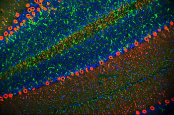 Anti-PKC gamma/PRKCG Antibody