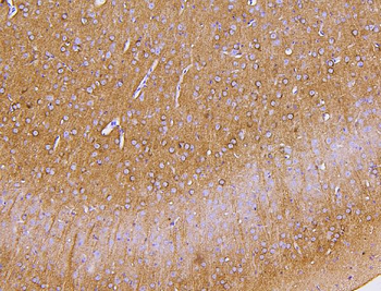 Anti-PKC gamma/PRKCG Antibody