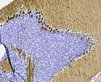 Anti-PKC gamma/PRKCG Antibody