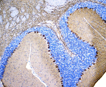 Anti-PKC gamma/PRKCG Antibody