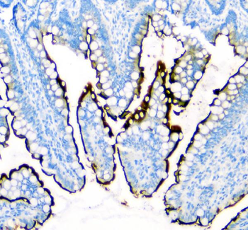 SI Antibody