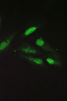 Anti-SRI Antibody