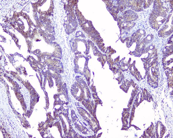 Anti-SRI Antibody