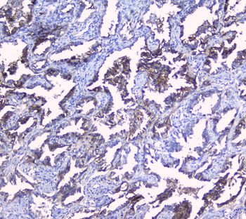 Anti-SRI Antibody