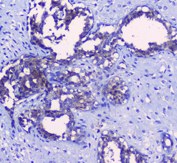 Anti-SRI Antibody