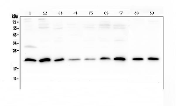Anti-SRI Antibody
