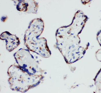 Anti-HSD17B1 Antibody