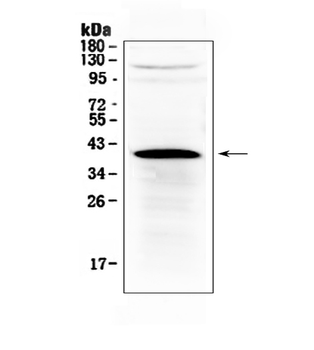 Anti-HSD17B1 Antibody