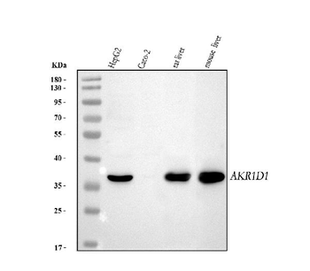 Anti-AKR1D1 Antibody