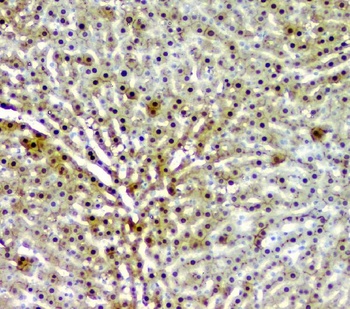 AKR1D1 Antibody