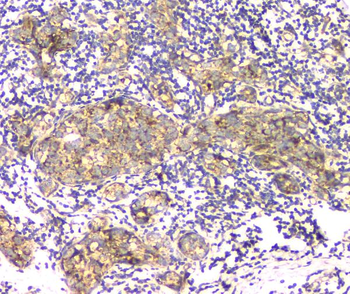 Anti-Aprt Antibody