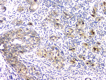Anti-Aprt Antibody