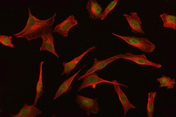 BAT3/BAG6 Antibody