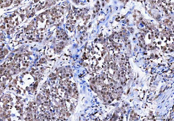 Anti-BAT3/BAG6 Antibody