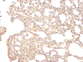 Anti-BMP15 Antibody