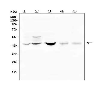 Anti-BMP15 Antibody