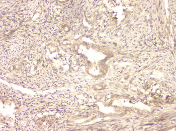 Anti-BMP15 Antibody
