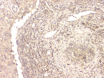 Anti-BMP15 Antibody
