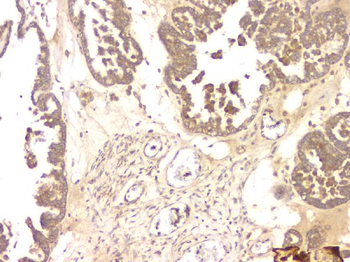 Anti-BMP15 Antibody