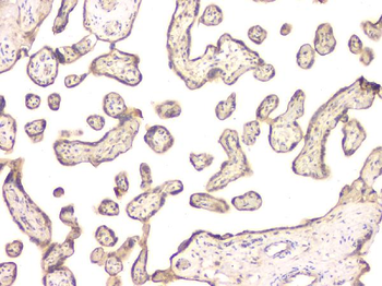 Anti-BMP15 Antibody