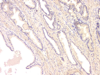 Anti-BMP15 Antibody
