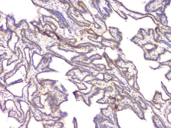 Anti-BMP15 Antibody
