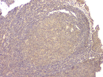 Anti-BMP15 Antibody