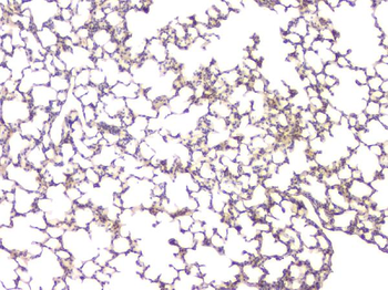 Anti-BMP15 Antibody