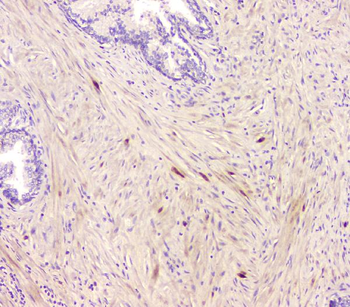 GPR2/CCR10 Rabbit Polyclonal Antibody
